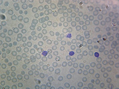 Blood Smear Human - Microscope Slide