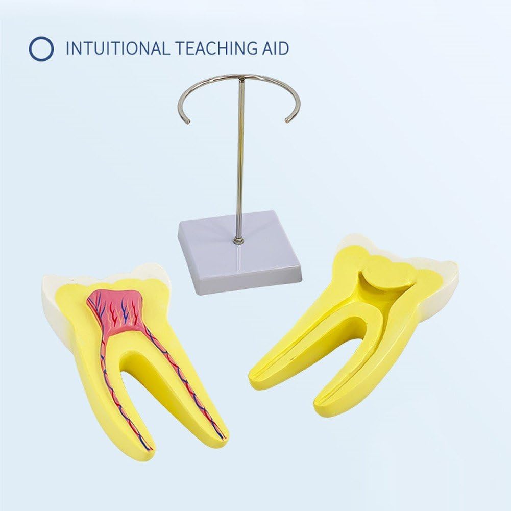 Modèle D'anatomie Modèle De Dents Molaires pour L'étude des Maladies Modèle De Dents Modèle De Dent Humaine