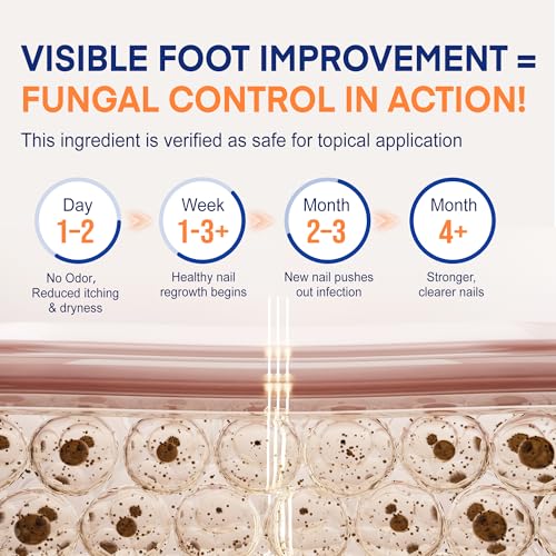 image for VigorWell Toenail Fungus Treatment with 25% Undecylenic Acid: Toenail 