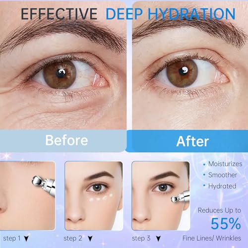 Under-Eye-Cream-for-Puffiness-Dark-Circles-Wrinkle-Bags-Under-Eyes-Eye-Repair-Cream-Anti-Aging-Moisturizer-Eye-Care-Cream-Suit-Women-Men-Eye-Firm-Smooth-07-oz