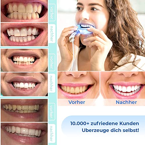 Bleaching-Gel P-Beauty Cosmetic Accessories zur Zahnaufhellung