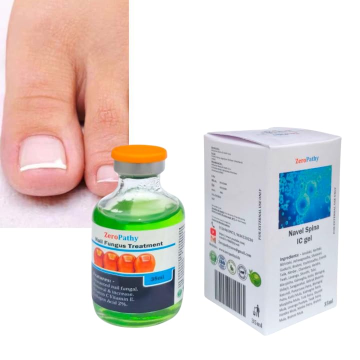 Image of Herbal Nail Treatment Lotion for Dry, Fungal, and Broken Nails | Encourages Healthy Nail Growth with Ayurvedic Power | Soothes Nail Beds, Repairs Texture, and Prevents Nail Lifting and Cracking