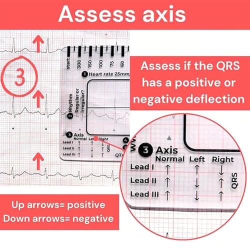Regla ECG 7 Pasos Transparente de Plástico para Interpretar ECG miniatura 4