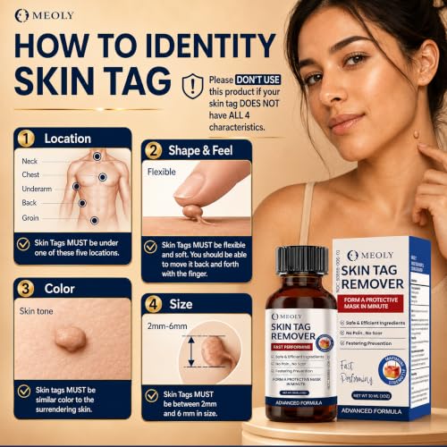 Image of MEOLY Fast-Acting Skin Tag Remover : Salicylic Acid Skin Tag for Men and Women 30 ml