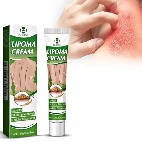 Crema Antifúngica 20g, crema antifúngica para la piel Alivia el picor inguinal, tiña, eczema, Antifúngico, Descamación, Alivia Rápidamente los Irritación Y Enrojecimiento en el Cuerpo Y la Cara