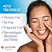 Glenmark Therapeutics Adapalene Gel 0.1% Acne Treatment, Paraben Free Topical Retinoid Cream For Face, Helps Clear and Prevent Acne and Clogged Pores, 45g Tube
