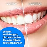 Polierpaste professional, Zahnpolierpaste mit Hydroxylapatit, Reingungspaste für Zähne 10 x 2 g Paste Zahnpolitur Prophy-Paste