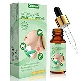 Skin Mole Remover for Face & Body - Fast Acting Wart Removal with Precise Dropper, Skin Tag Remover for Corns, Calluses, Flat, Plantar & Common Warts, for Body and Hands - 15ml