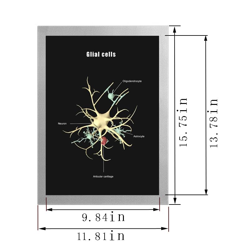 Image of Taanfu Body Educational Learning Anatomy Posters ，Glial cells Art cells Villi Anatomy Art Poster Digestive System Organs Illustration Small Intestine Physiology Anatomy Wall Art Villi