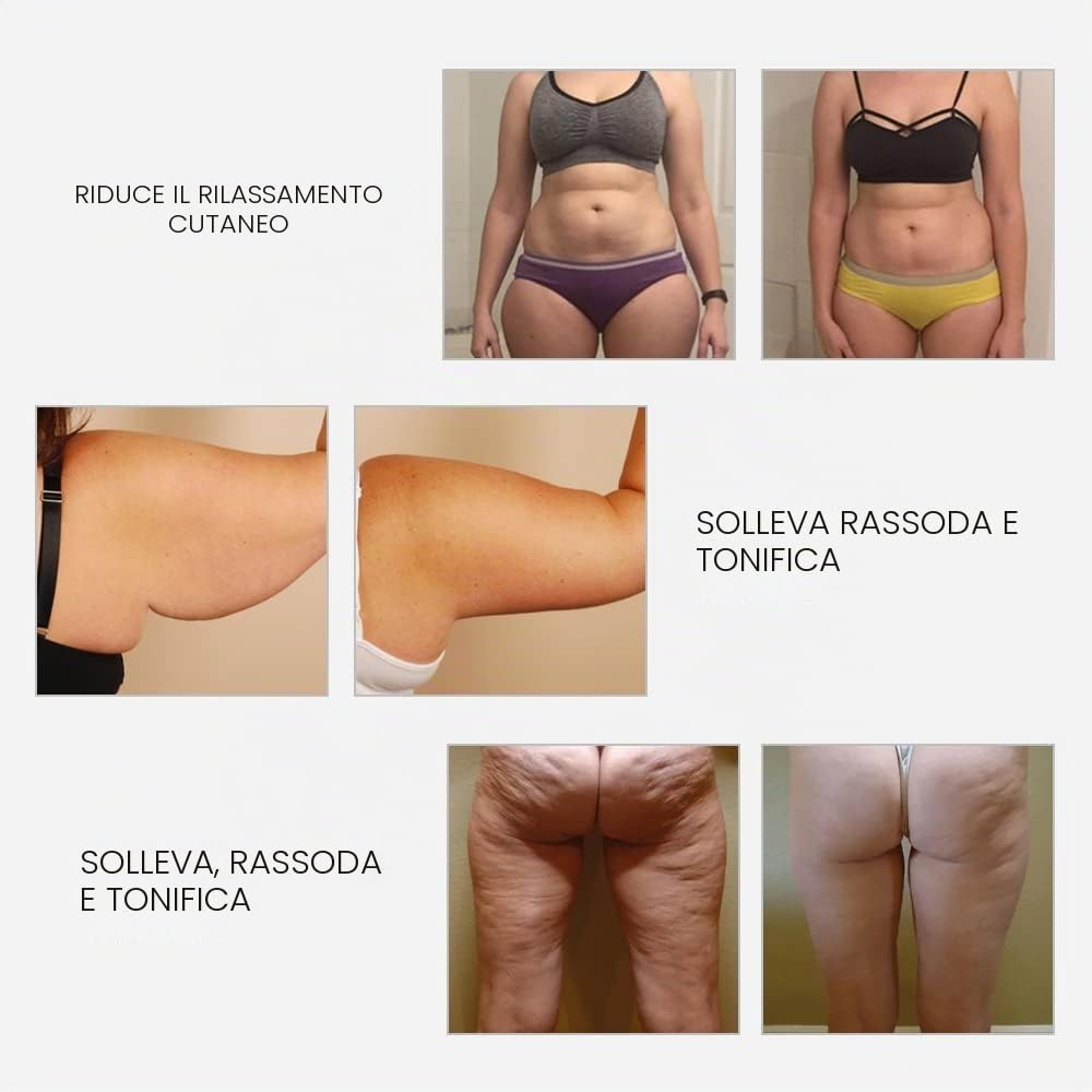 RF Radiofrequenza viso e corpo macchina rassodante – Professionale Home RF Lifting Skin Care Anti Aging Device – Effetti salone / più sicuro (bianco)
