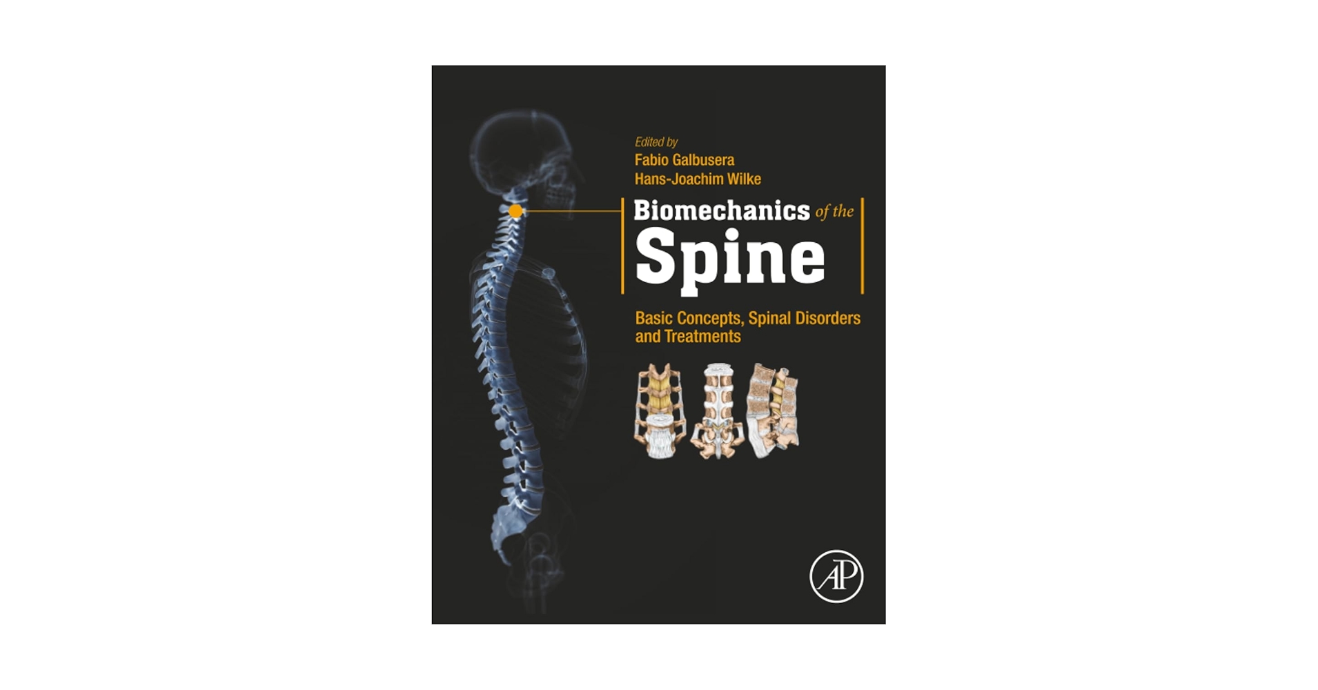 脊椎脊髄病学 = PRINCIPLES OF SPINAL DISORDERS 脊椎脊髄病学 = PRINCIPLES OF SPINAL DISORDERS Spinal Trauma