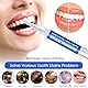 2 Stück Mit Teeth Whitening, Zahnaufhellung Bleaching Stift, Zahnaufhellung Stift, Whitening Teeth, Schnelles Wirksam Entfernen Flecken