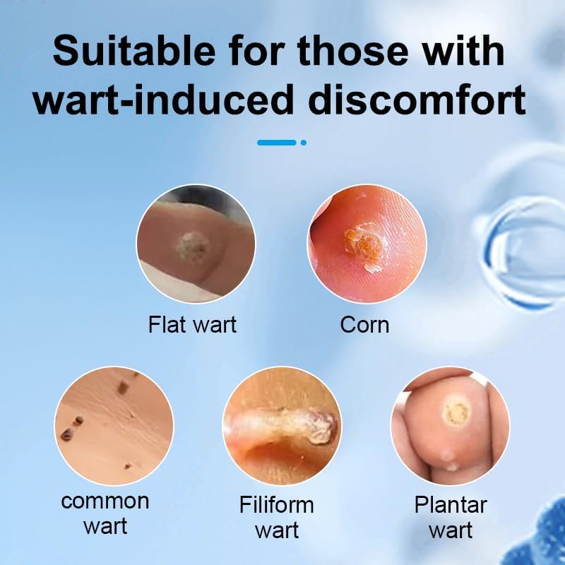 Skin Wart Removal for Face & Body - Mole and Wart Remover Serum, Fast Acting Removal for Plantar, Common & Flat Wart, Suitable for Sensitive Skin(0.085FL.OZ) - Image 2