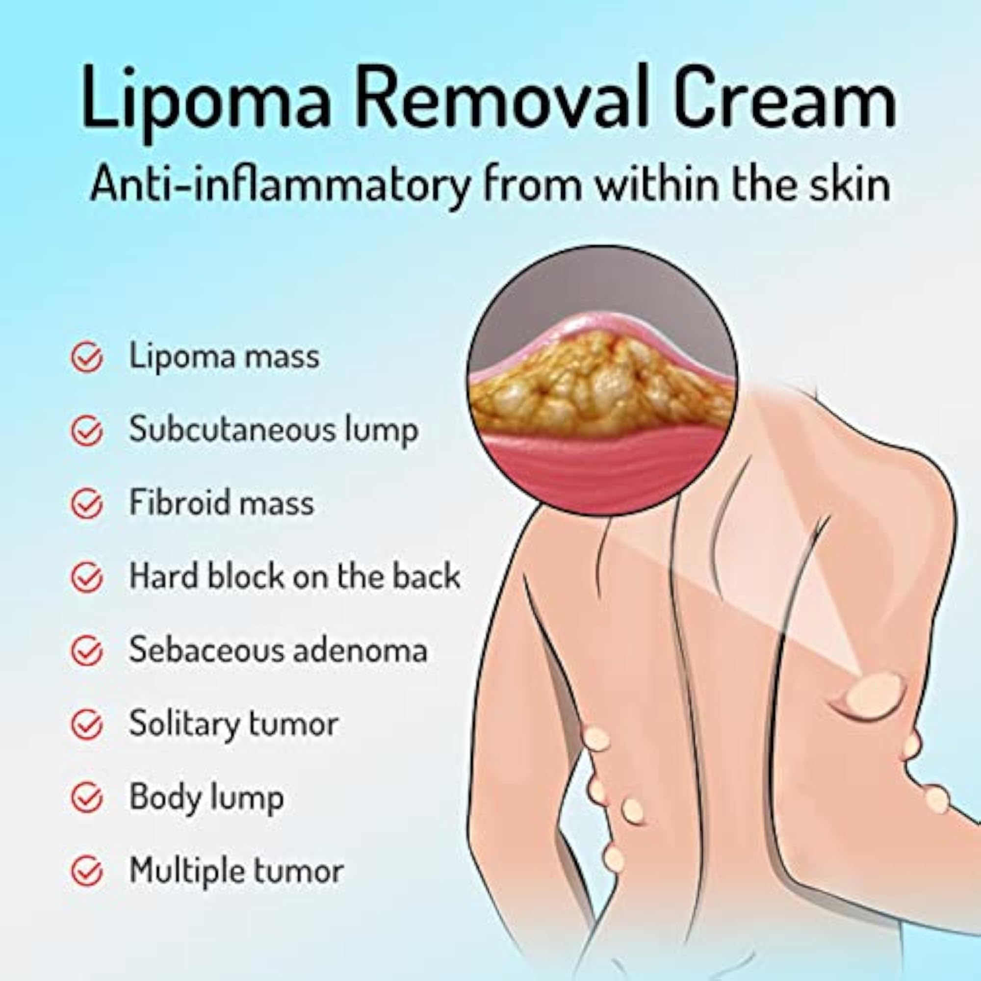 LOOM TREE 20g Lipoma Removal Cream, Herbal Care Cream