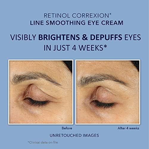 Roc JOHNSON & JOHNSON CONSUMER INC. Retinol Correxion Value Set Duo, Deep Wrinkle Anti-Aging Night Face Cream + Daily Under Eye Cream thumb #2