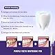 Zahnaufhellung Whitening Pen, Purple Teeth Bleaching Stift, Zähne Aufhellen Efficiently Schnelles Removes Tough Stains, Zahnweiss Set (3 Stück)