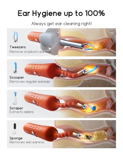 Image of Bebird D39R Ear Wax Removal:Ear Camera with Storage Case &Painless Tweezers