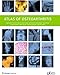Atlas of Osteoarthritis