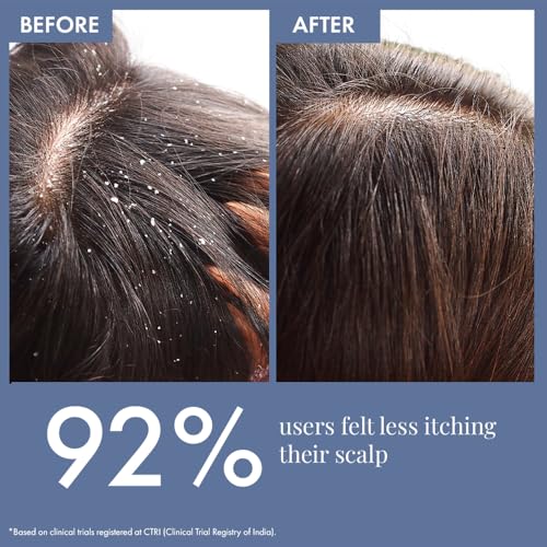 Image of ThriveCo Scalp Clear Shampoo for Dandruff Control | Daily Use Shampoo With Zenscalpin, Hyaplex, Salicylic Acid | For Dandruff, Flaky & Itchy Scalp | For Men & Women 100 ml