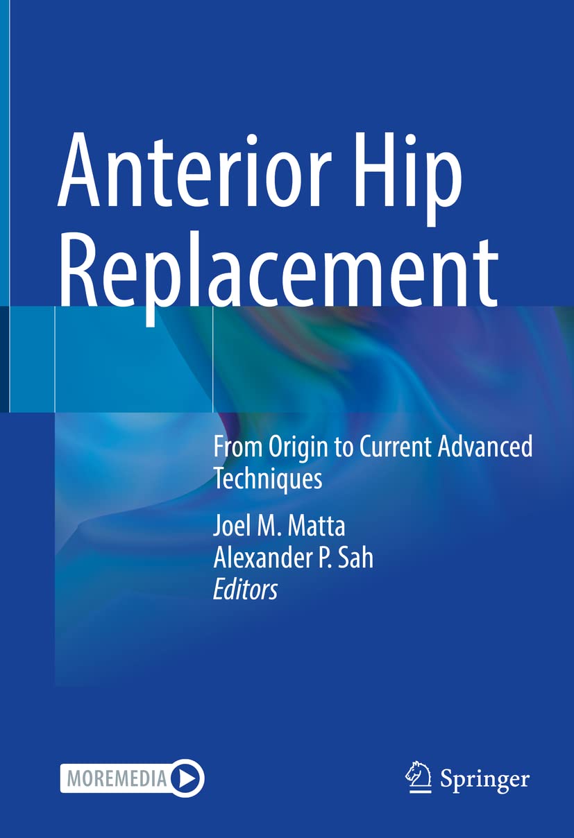 Buy Anterior Hip Replacement: From Origin to Current Advanced Techniques — BookShops.in