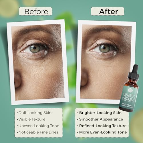 Facial Massager - 7 in 1 Face Cleaner Lifting Machine - High Frequency Machine - Promote Face Cream Absorption - LED Blue & Red Light Wave - Lift & Firm Tighten Skin Wrinkles - Skin Care Tools