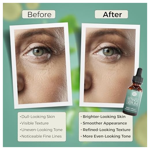 Bioniva Retinol Liposomen Liefersystem mit Vitamin C & Vegan Hyaluronsäure - Anti-Aging Lift Serum, Für Gesicht, Dekolleté und Körper