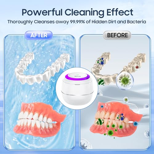 Hiwill DL-320 Ultrasonic Cleaner Retainer Cleaning Machine: 43Khz Ultra Sonic Cleaner Pod For Mouth Guard Denture - Professional Dental Cleaning Braces Night Guard thumb #4