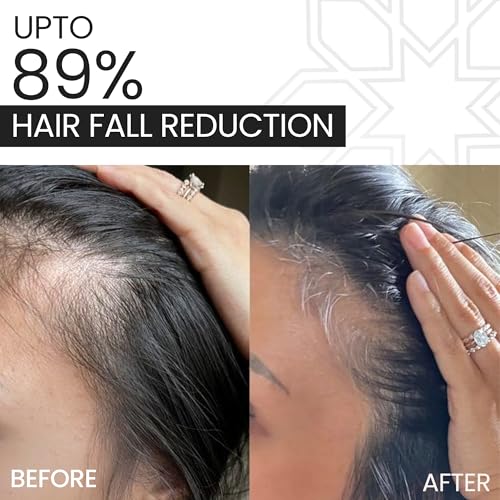 Image of STEM SERUM, Intensive Hair Growth Serum, Reduces Hair Fall and Hair Loss, Boosts Scalp Health, Contains Capilla Longa, Dermatologically Tested, All Hair Types, For Men and Women, 60ml.