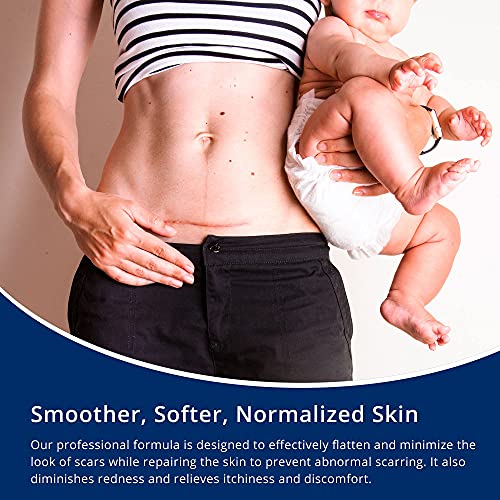 100 silicone scar gel scar cream - advanced scar gel for surgical scars c-section stretch marks acne injury burns keloids old and new scars 106oz30g maximum strength 100 silicone