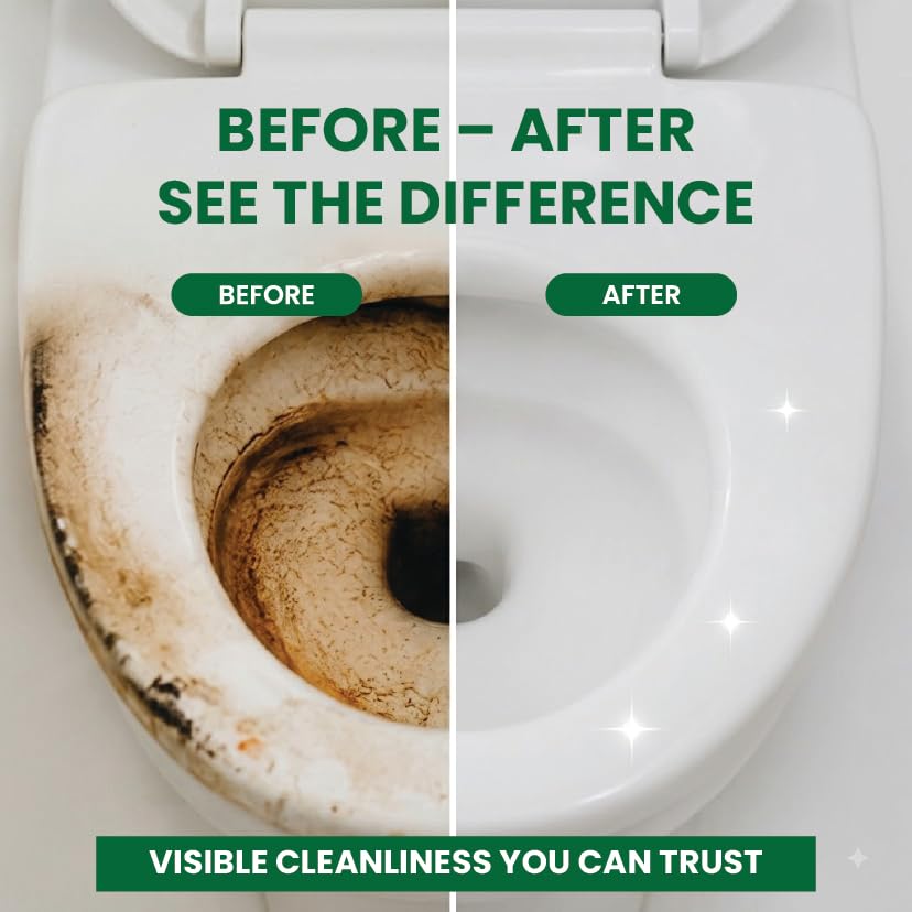 Image of Natural Toilet Cleaner | Kills 99.9% Germs | Probiotic & Enzyme Formula | No Toxic Fumes | Stain & Odor Resistant | Eco-Friendly & Septic Safe | 500 ML