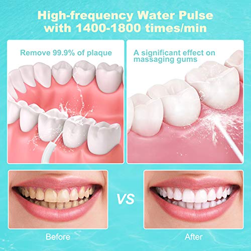 image for homgeek Cordless Water Flosser,Upgraded Professional Dental Oral Irrig