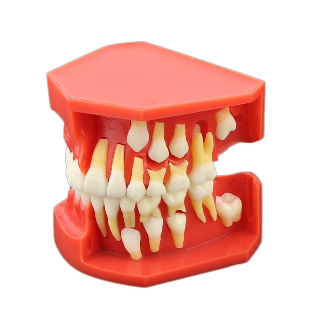 1: 1 Simulación Modelo Dental Modelo De Desarrollo De Erupción De Dientes, Modelo Dental Alterna De La Presentación De Reemplazo De Dientes De Hoja Caduca para Niños para Explicar