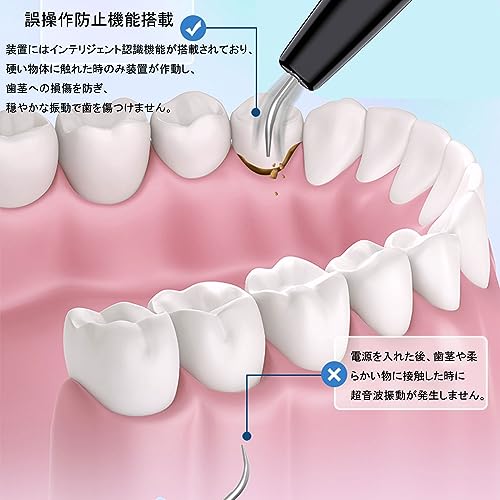 Micfendy 超音波歯クリーナー 口腔洗浄器 の商品画像 4