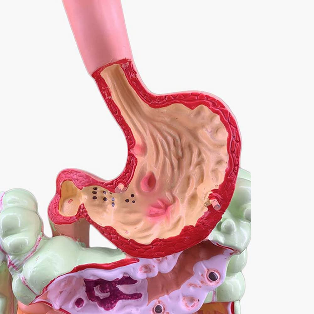 Modello 'apparato digerente Umano Anatomia gastrica Intestino Retto Duodeno Modello degli Organi Interni 'uomo