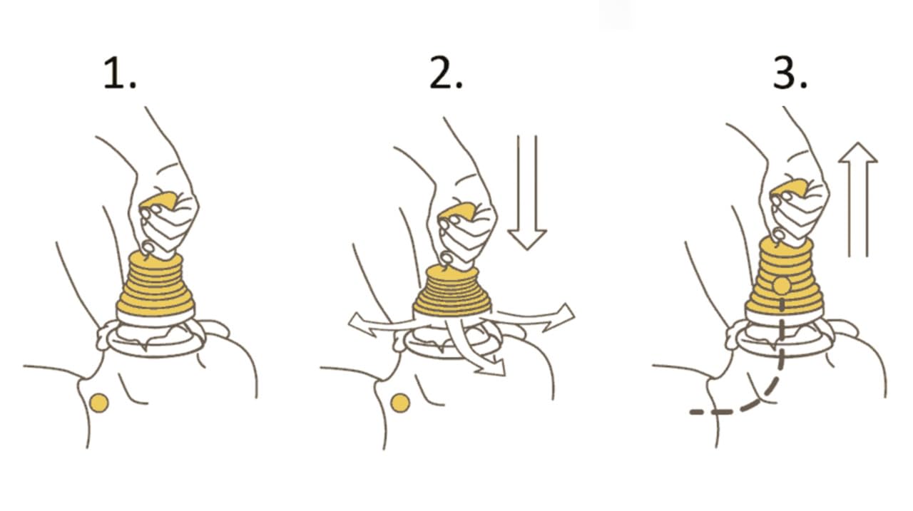 LifeVac Duo Pack 2 Kits Antiatragantamiento para Adultos y Niños con 4 Mascarillas