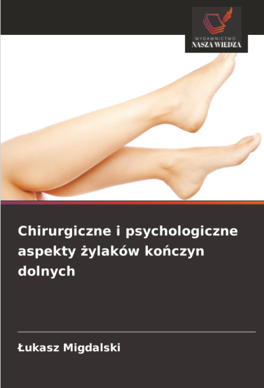 Chirurgiczne i psychologiczne aspekty żylaków kończyn dolnych