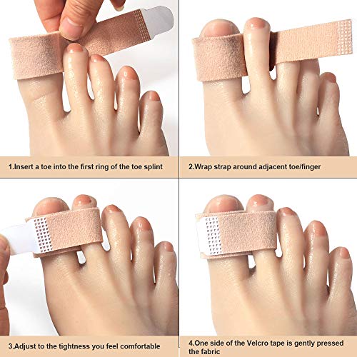 Image of Lengthened Broken Toe Wraps for Your Big Toes, 8 Pcs /Pack Fabric Toe Splint Toe Cushioned Bandages Finger Protectors Straightener Hammer Toe Separators