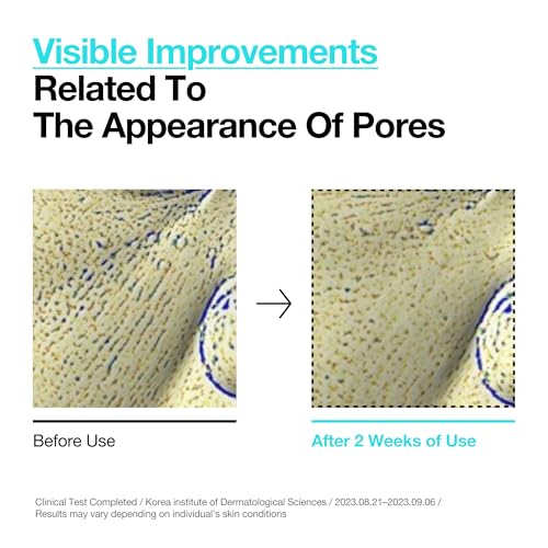 ANUA BHA 2% Gentle Exfoliating Toner, Mild Facial Exfoliant, Salicylic Acid for Pores and Sebum, Teatree Extract, Hyaluronic Acid, Ceramides (150ml / 5.07 fl.oz.) - Image 6