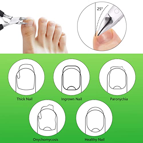 Feiccier XGH0007 Heavy Duty Ingrown Toenail Clippers thumb #4