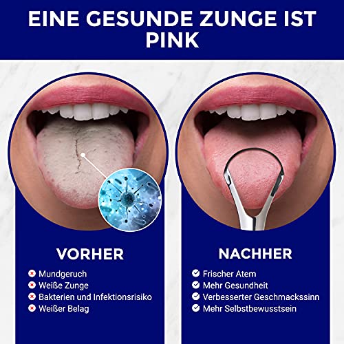 Zungenschaber Edelstahl | Zungenreiniger Set | Zungenputzer | Zungenbürste aus Edelstahl | Zungenkratzer aus Edelstahl | Tongue Scraper | Zungenreiniger Edelstahl | ORAVIX