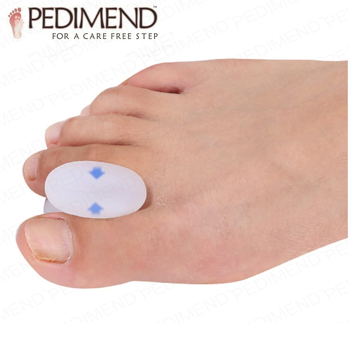 4 x Pedimend gel per dita per alluce valgo | dito separatori per alluce valgo | Overlapping Toes Barelle | Adatto per l' utilizzo in sport lavoro vestito e scarpe