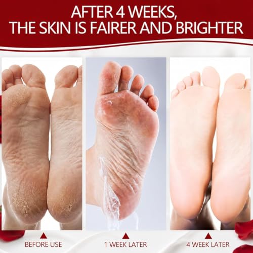 2 Paires Masque Pieds Exfoliant - Soin Peaux Mortes et Talons Secs – vue 5