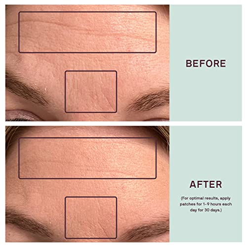 Dermaclara Forehead Wrinkle Patch - Silicone Fusion Treatment Forehead Patches for Wrinkles & Fine Lines - Anti-Wrinkle Patches for Pregnancy Safe SkinCare - Reusable up to 30 Times - Thumbnail 5