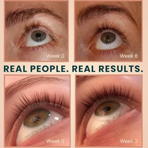 Live Fraiche Organic Castor Oil Lash & Brow Serum 2oz — view 5