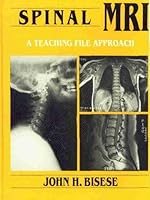 Spinal MRI: A Teaching File Approach 0070054061 Book Cover