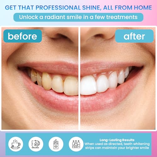 Image of Teeth Whitening Strips 14 Treatments (28 Strips) - Deep Stains Removel - Enamel Safe Whitening Strips - Instant Teeth Whitening Strips
