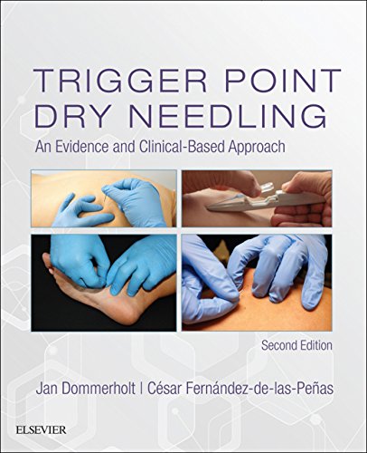 Trigger Point Dry Needling E-Book: An Evidence and Clinical-Based Approach