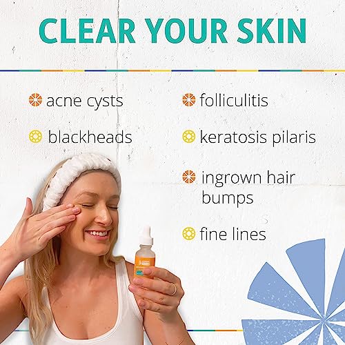 Face & Body Clearing Serum, Level 1-4 Fl Oz- For Acne, Folliculitis, Aging Skin, Ingrown Hairs, Dark Spots - Mandelic Acid #TOP6