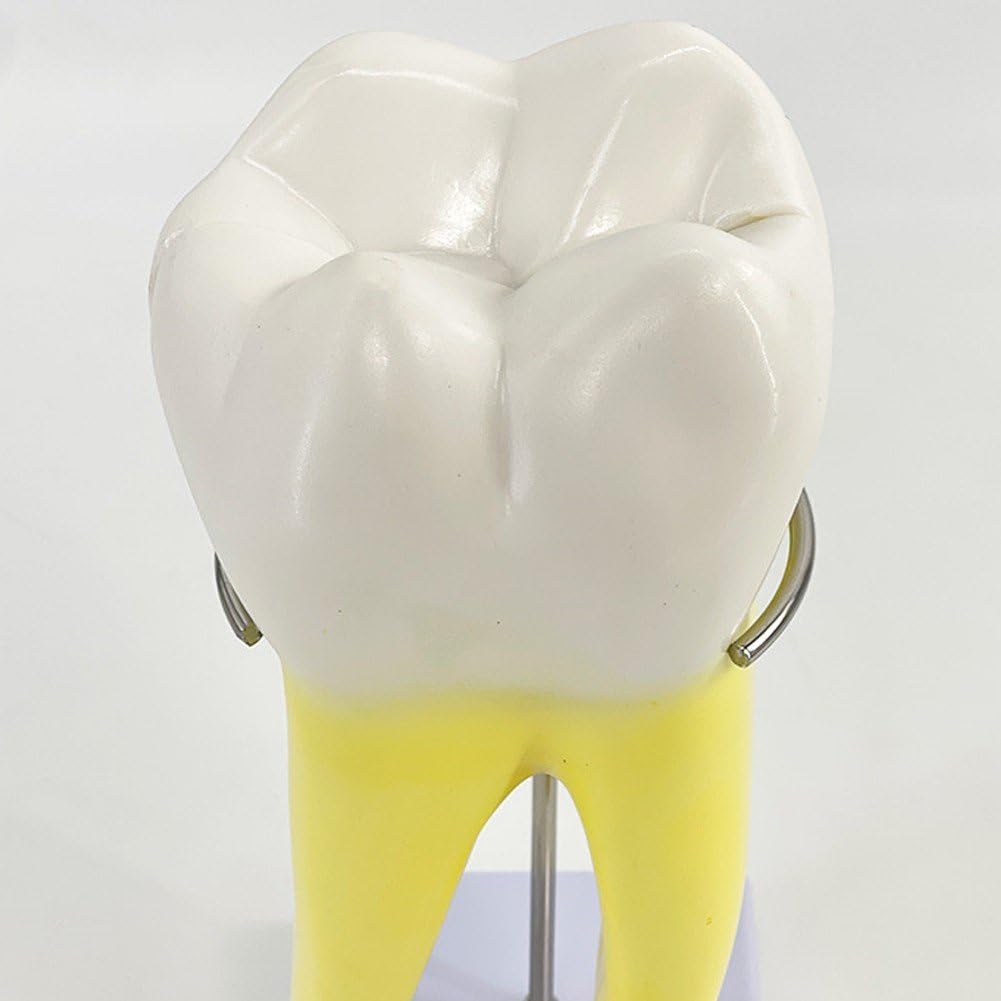 Modèle D'anatomie Modèle De Dents Molaires pour L'étude des Maladies Modèle De Dents Modèle De Dent Humaine