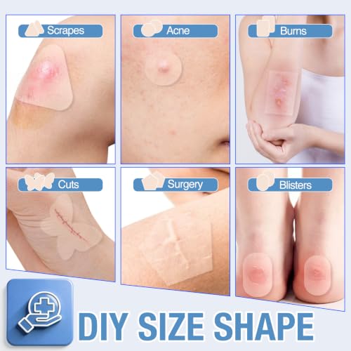 Image of Hydrocolloid Roll, Waterproof Bandage, Wound Dressing, Pimple Patch Roll